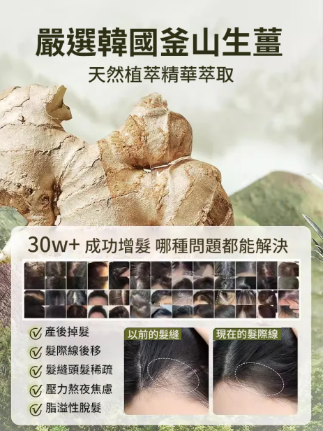 爆款生薑植萃防脫育髮洗頭膏 火爆熱銷中!台灣本土出貨!24小時在線客服,售後無憂!現在下單享受在線支付立減活動! 爆款生薑植萃防脫育髮洗頭膏 火爆熱銷中!台灣本土出貨!24小時在線客服,售後無憂!現在下單享受在線支付立減活動!